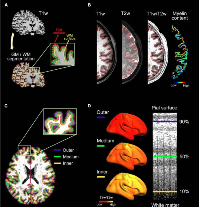 髓鞘含量分析系统