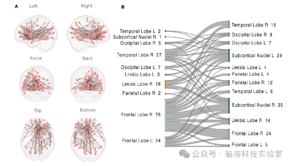 PLOS ONE：VR 游戏扫描揭示了 ADHD 儿童独特的大脑活动