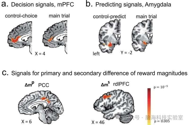 J. Neurosci.：人类决策时对他人期望的处理大脑机制