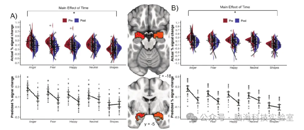 Nature子刊：一项新的非侵入性脑刺激技术可以使抑郁、焦虑和 PTSD症状显著减少