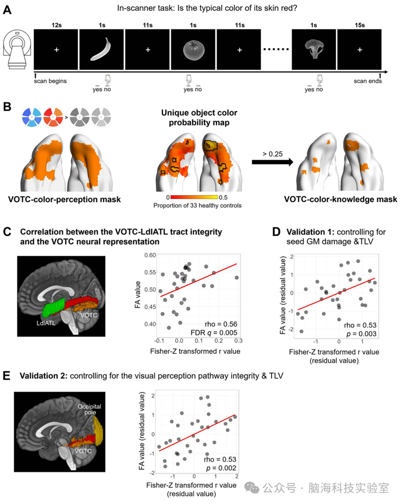 PLOS Biology：视觉与语言的神经联动，竟是大脑认知物体的关键！