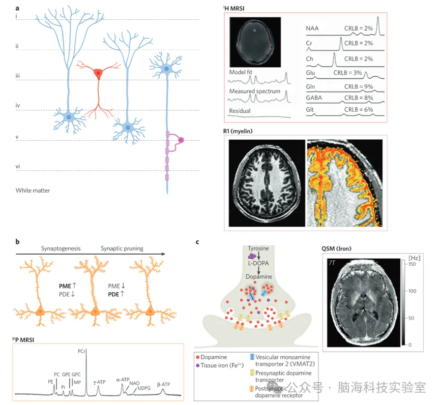 Neuropsychopharmacol：精神病学领域7T磁共振技术的研究进展