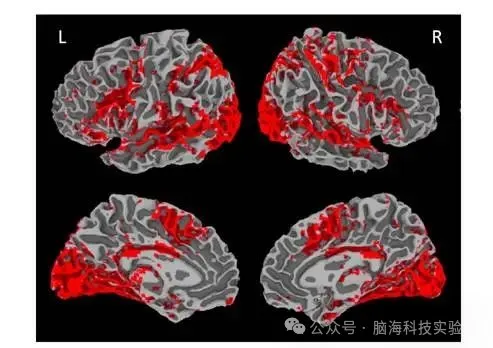 Hum Brain Mapp ：双语大脑如何分工？脑科学研究揭示语言表征奥秘