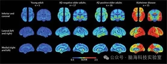 Nat Rev Neurol：阿尔茨海默病中的人类连接组——与生物标记物和基因的关系