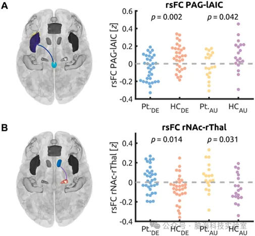 NeuroImage ：复杂性区域疼痛综合征中的功能连接：一项双中心研究