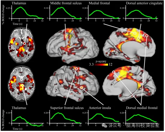 Am J Psychiat：研究发现：妈妈越焦虑，新生儿对声音的反应越不一样