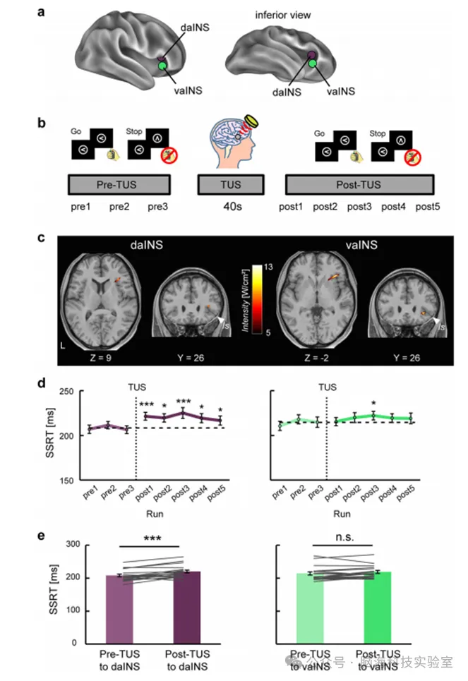 往期精彩|Nature Communications：多个岛-前额叶通路是人类反应抑制期间感知到执行的基础