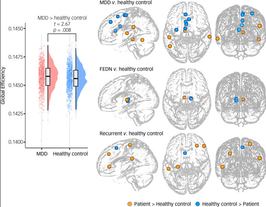 抑郁合集二 | 以往高分文献分析，揭示抑郁研究热点