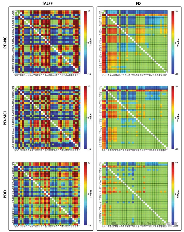 往期精彩|Movement Disord：脑动力学复杂性作为帕金森病患者认知能力下降的标志