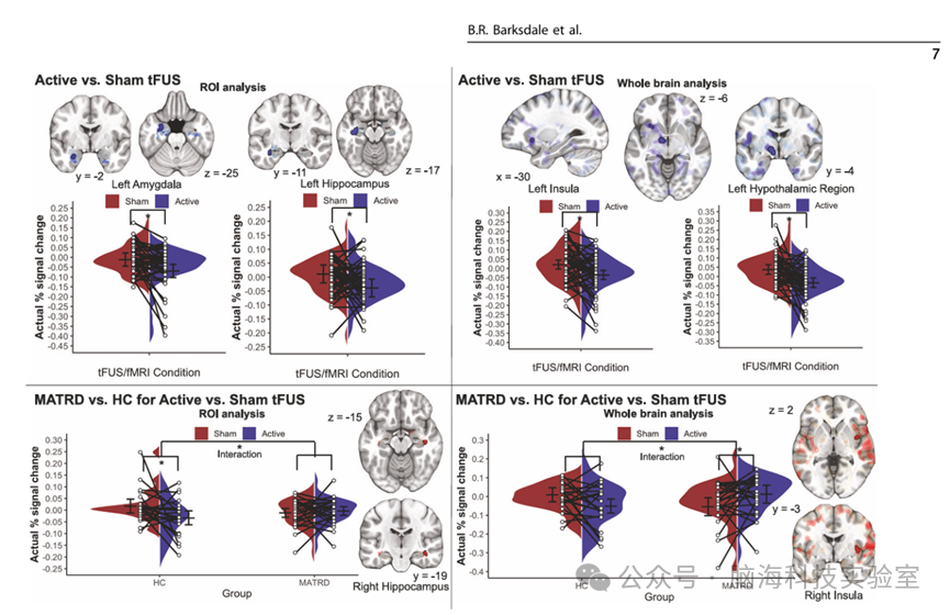 焦虑合集 | 以往高分文献分析，揭示焦虑研究热点