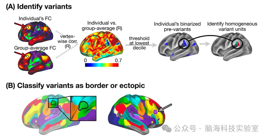 Nature子刊：人类大脑功能性网络中两种常见但不同的变异形式