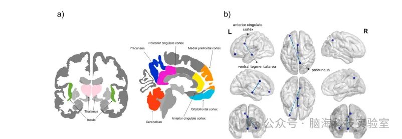 往期精彩|Journal of Affective Disorder:重度抑郁症的超高场成像:结构和功能研究