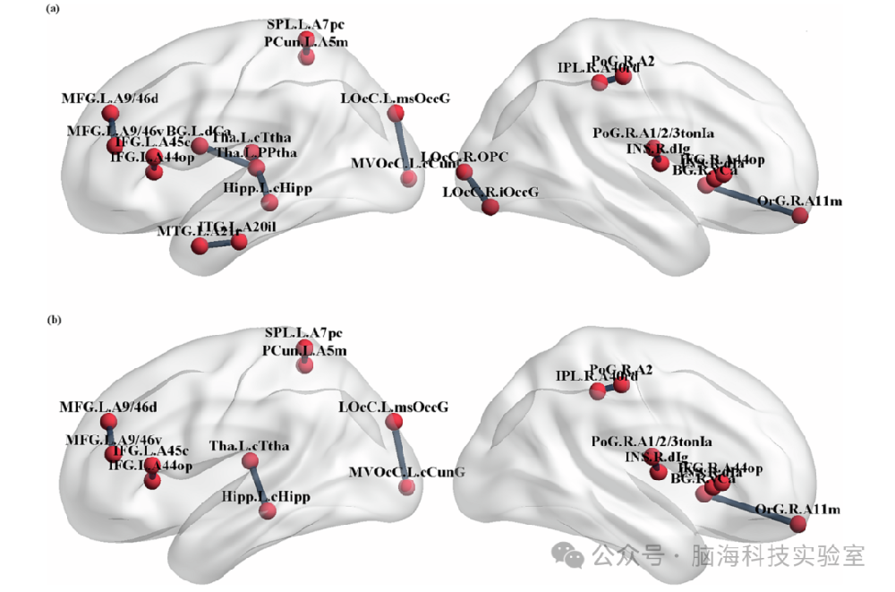 往期精彩|NeuroImage Clin：基于DTI结构连接性预测新发帕金森病轻度认知障碍