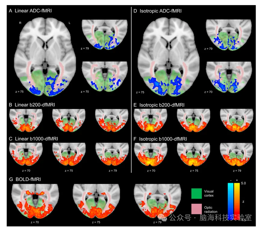Neuroscience：使用各向同性 ADC-fMRI 绘制人脑中的灰质和白质活动图谱