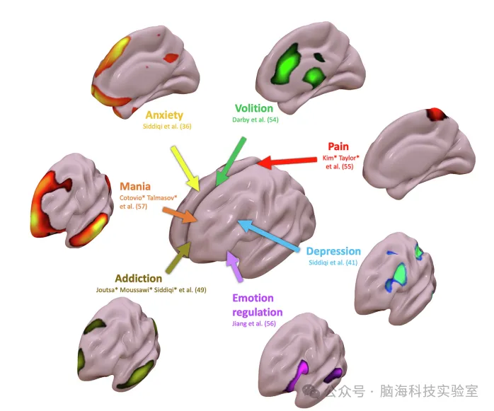 往期精彩|Biol Psychiat:经颅磁刺激靶向治疗的特异性网络