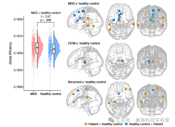 往期精彩|Br J Psychiatry:重度抑郁症患者灰质结构网络的拓扑结构和连接性受损:来自多中心神经影像数据集的证据