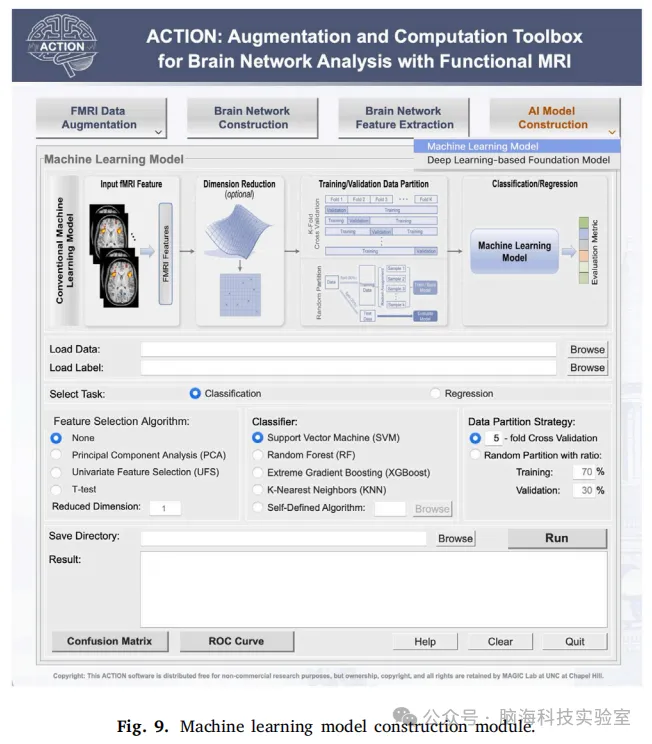 往期精彩|ACTION:用于功能性MRI脑网络分析的增强和计算工具箱