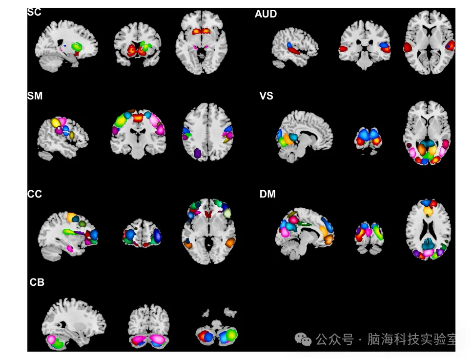 往期精彩|NeuroImage:膝关节炎如何影响大脑?静态与动态功能网络变化全解析