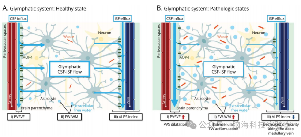 往期精彩|Neurology:轻度认知障碍和阿尔茨海默病中淋巴系统MRI指标与淀粉样蛋白沉积和认知的关系