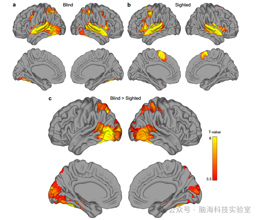 Nature Communications：先天盲人与视力正常人群对名词和动词的神经表征