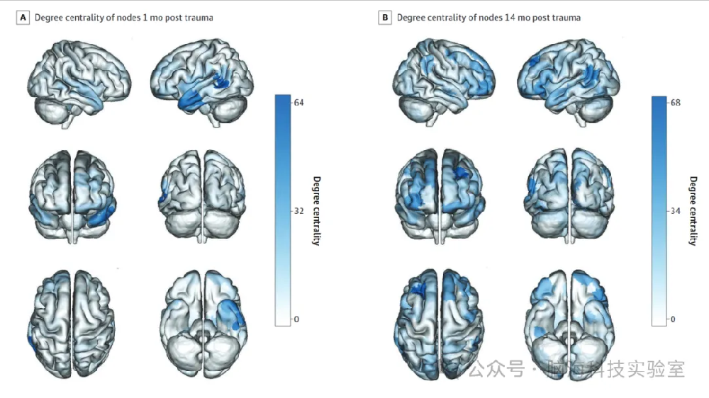 往期精彩|JAMA Netw. Open：机器学习解码大脑：精准预测PTSD症状新突破