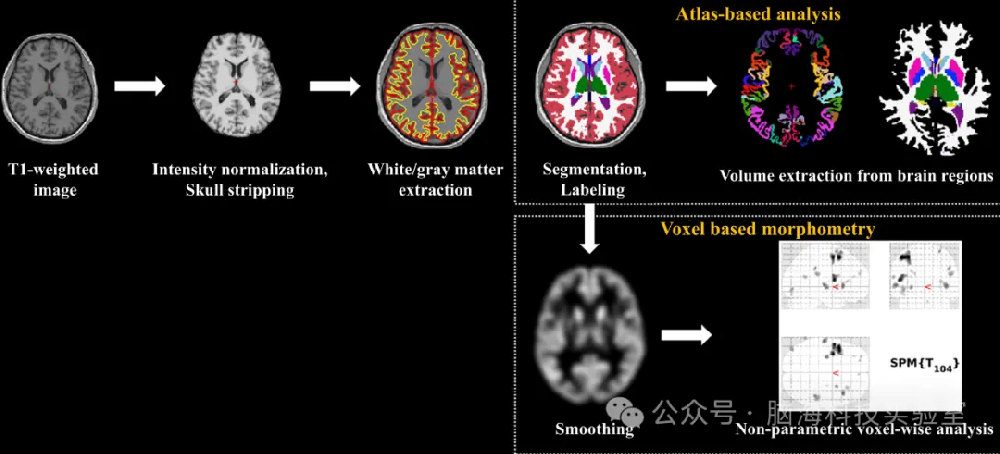 往期精彩|OEM：新发现！长时间工作可能会改变大脑结构