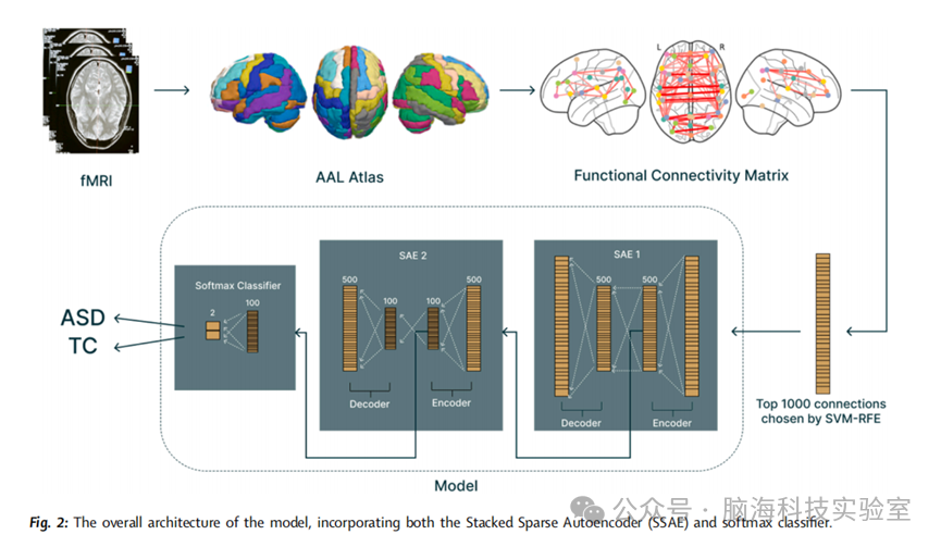 eClinicalMedicine：使用可解释的人工智能从功能磁共振成像数据中识别孤独症诊断的关键大脑区域