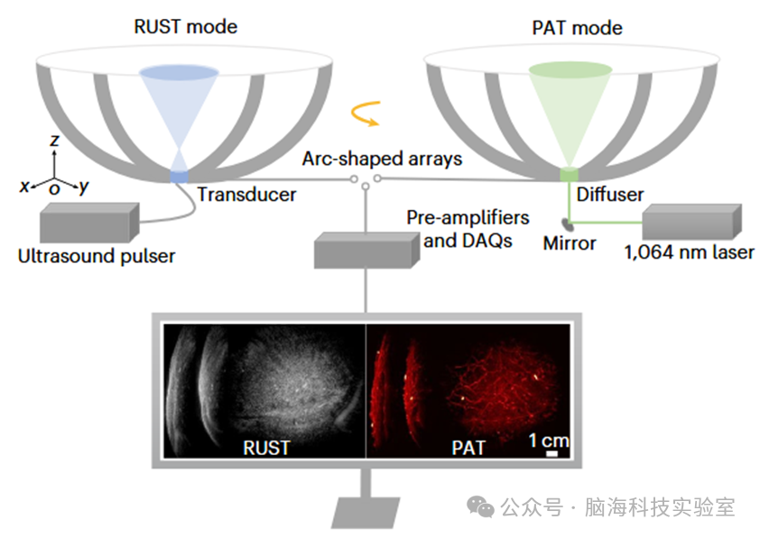 Nature子刊：新技术！三维混合成像系统可以弥补MRI、CT和超声的局限性