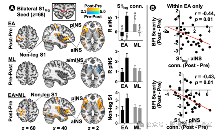 往期精彩|Arthritis Rheumatol：为什么针灸能缓解纤维肌痛？大脑研究发现关键在这里