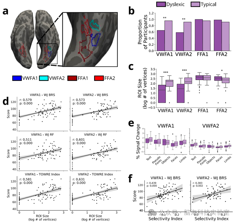 Nature子刊:fMRI扫描揭开阅读障碍的神经真相