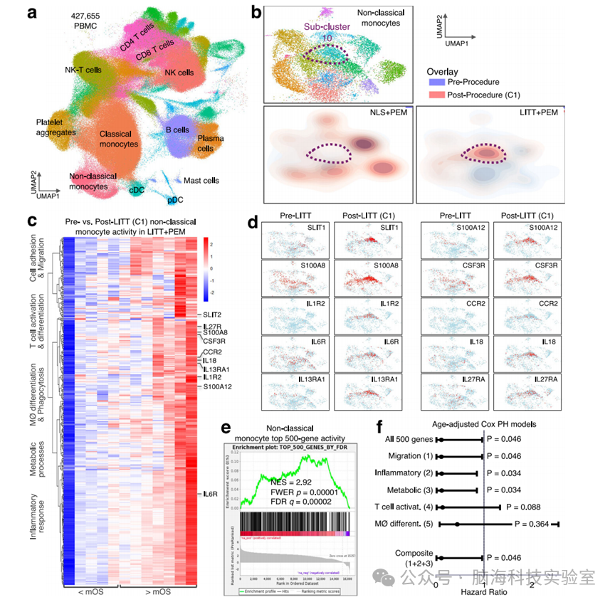 Nature子刊：新发现！激光热疗法加免疫疗法可能提高脑癌患者的生存率