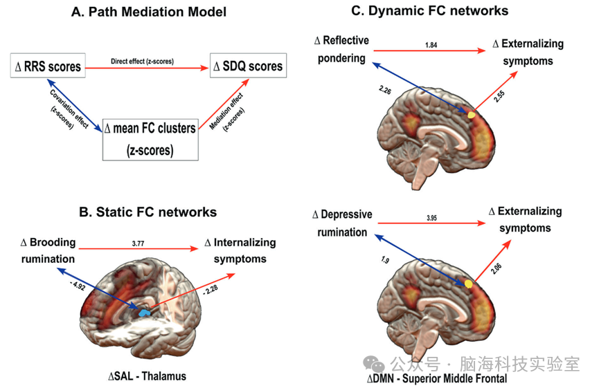 往期精彩|Mol Psychiatr:在向成年过渡的过程中,反刍思维和休息状态大脑网络之间的耦合变化