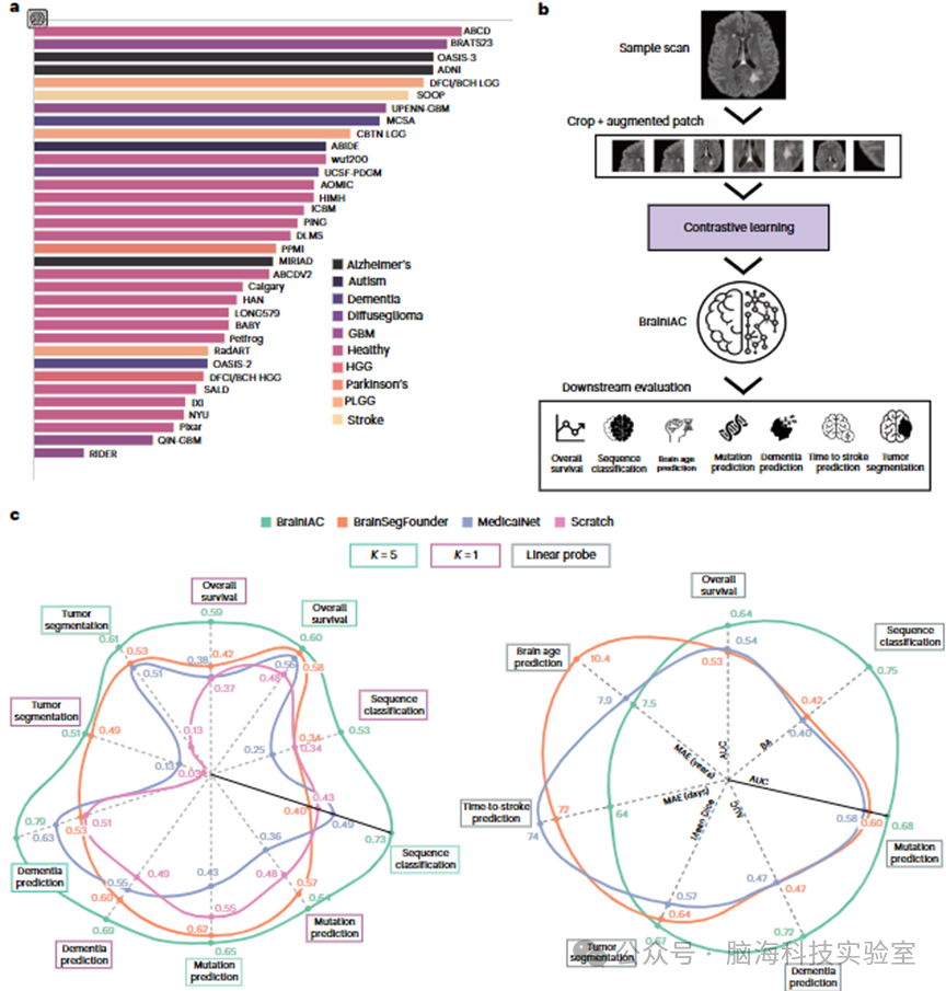 Nature子刊:新发现!新的AI模型能够使用MRI数据预测多种脑部疾病
