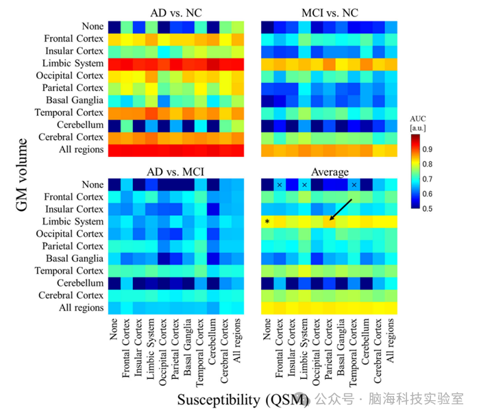 往期精彩|Eur Radiol：基于定量磁化率成像和体素形态学测量的诊断指标可能有助于改进阿尔茨海默病的早期诊断