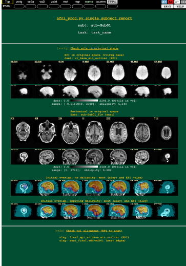 脑海科技产品介绍 | 多模态脑影像质量控制系统