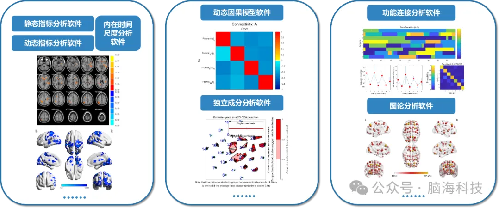脑海科技产品介绍 | 静息态功能磁共振数据分析解决方案（上）